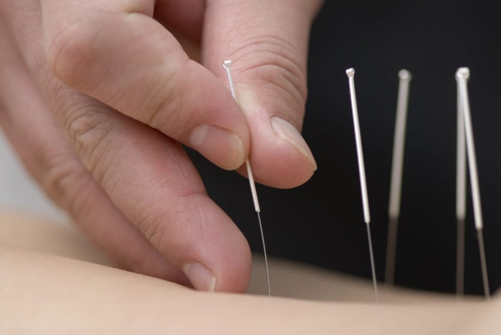 Acupuncture for chronic pain and depression Age In Place Home Care 1